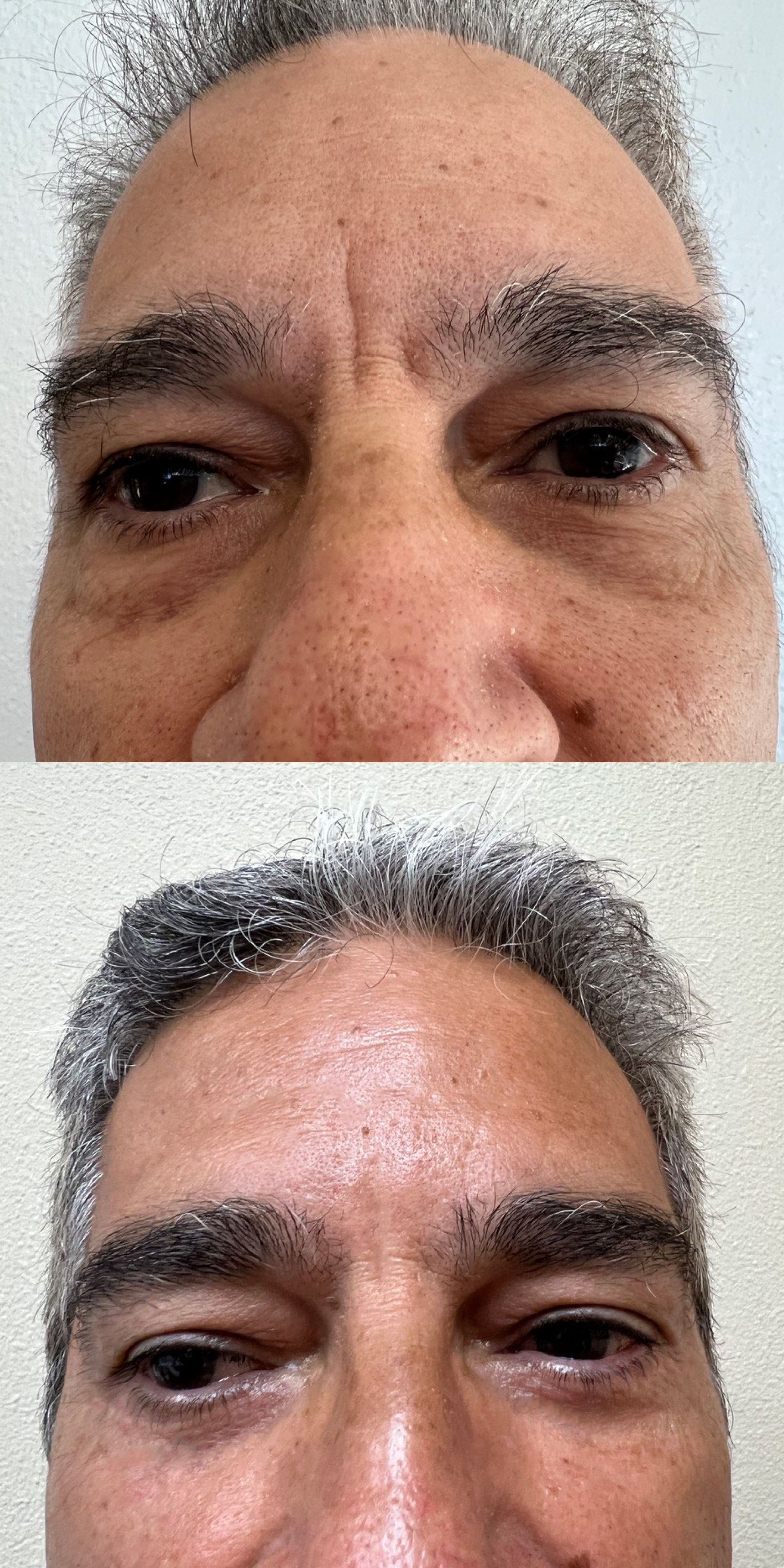 Before and After Image of Man